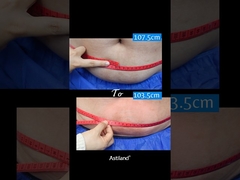 Fett einfrieren, 4 Zentimeter in einer Stunde verlieren!