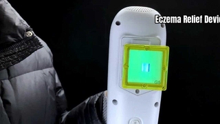 Linderung von Ekzemen: 308-nm-Excimer-Lichttherapiegerät