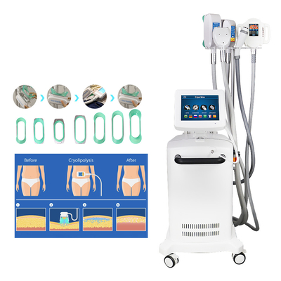 Abkühlende Skulptur Cryolipolysis, das Maschine für Fettabbau abnimmt
