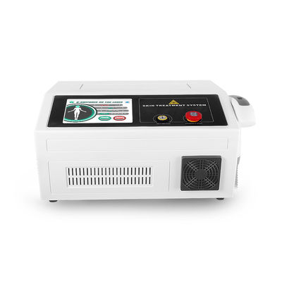 Pigment Q ISO 532nm schaltete Nd Yag Laser-Maschine
